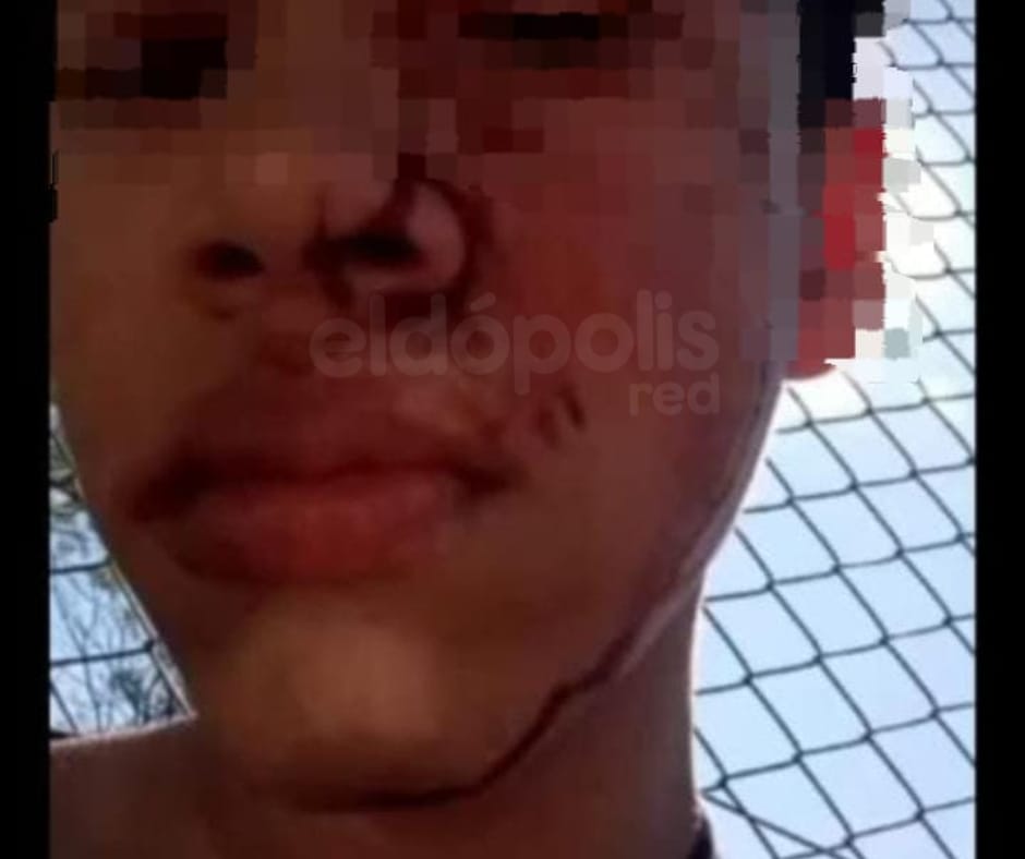 Adolescentes se enfrentaron a los golpes a la salida de la escuela en Eldorado